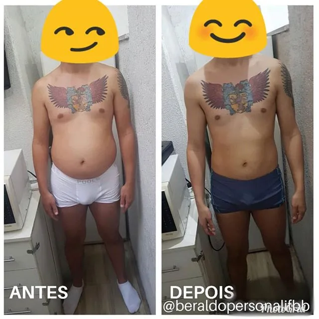 Antes e depois de aluno acompanhado pelo Dr. Beraldo
