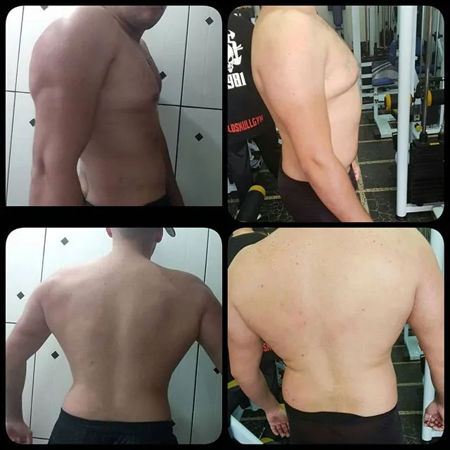 Antes e depois de aluno acompanhado pelo Dr. Beraldo