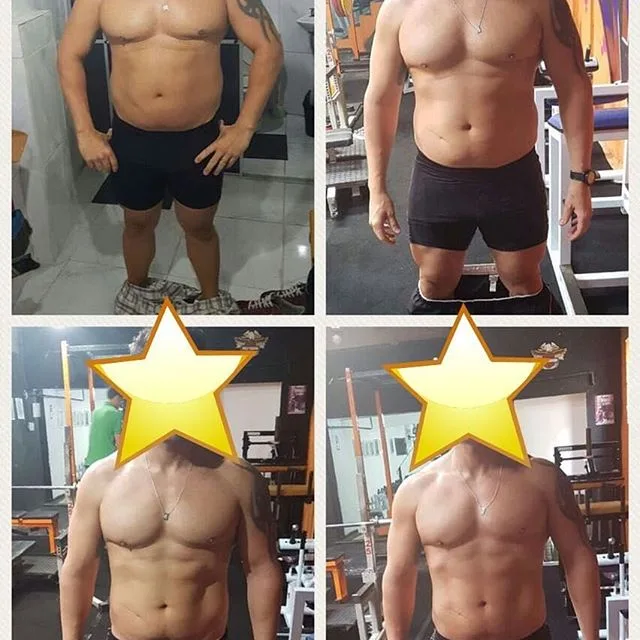 Antes e depois de aluno acompanhado pelo Dr. Beraldo