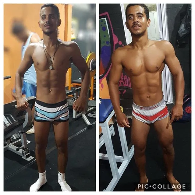 Antes e depois de aluno acompanhado pelo Dr. Beraldo