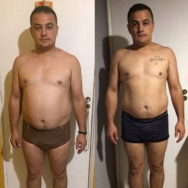 Antes e depois de aluno acompanhado pelo Dr. Beraldo